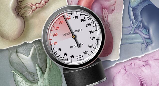 Hypertension is characterized by systolic blood pressure values ​​above 140 mmHg